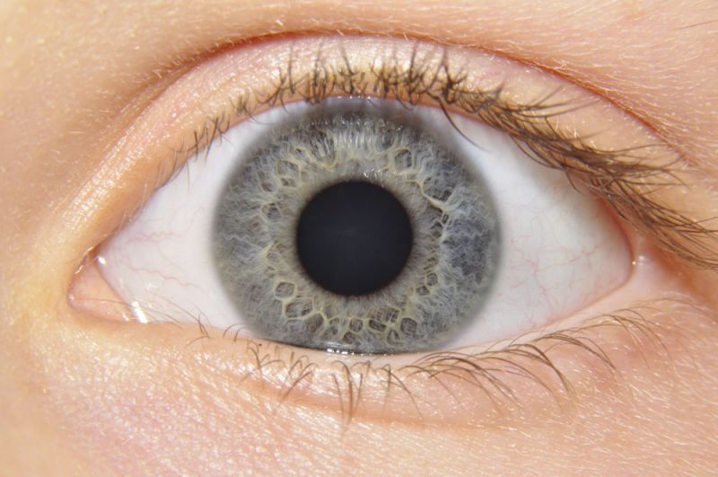 1. Auge - Iridologie (Augendiagnose/Irisdiagnose)