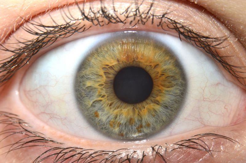 3. Auge - Iridologie (Augendiagnose/Irisdiagnose)